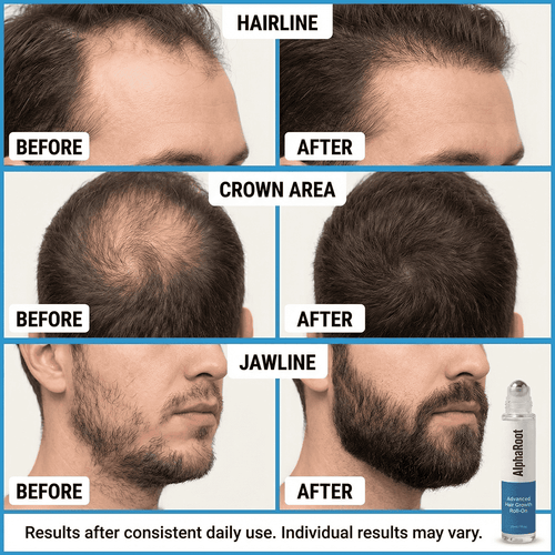 Advanced Hair Growth Roll-On